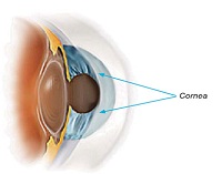 Cornea or Keratoconus Treatment in mumbai