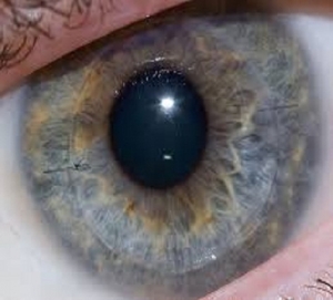 Descemet’s Membrane Endothelial Keratoplasty (DMEK)
