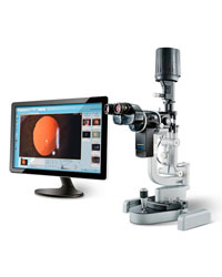SLIT LAMP